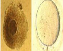 未成熟卵体成熟卵体外成熟技术